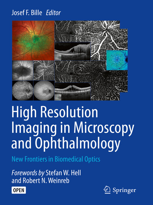 Title details for High Resolution Imaging in Microscopy and Ophthalmology by Josef F. Bille - Available